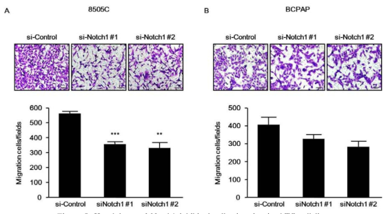 Knockdown of Notch1 inhibited cell migration in ATC cell lines