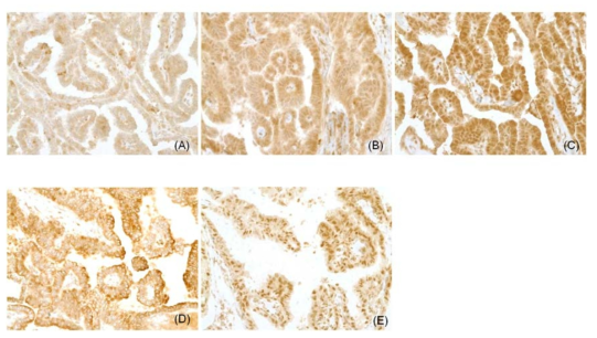 Expression of activated Notch1 and Hey1