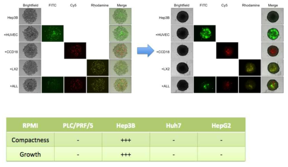 RPMI 배지에서 간암세포주에 따른 다세포 오가노이드 형성의 비교