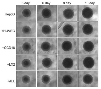 RPMI 배지에서 Hep3B 간암세포주 오가노이드 배양