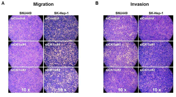 Migration and invasion assay for SNU449 and SK-Hep-1 cell lines. Both migration (A) and invasion (B) activities were not different between control and CK1 α knock-down cell lines