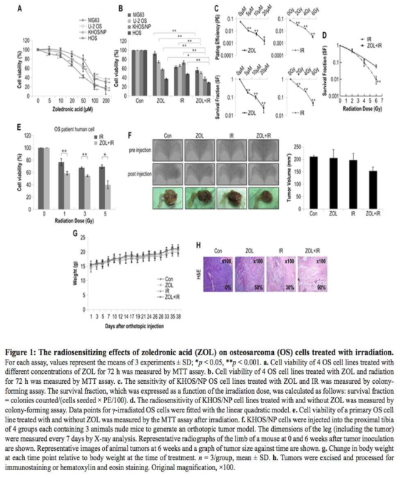 The radiosensitizing effects of zoledronic acid (ZOL) on osteosarcoma (OS) cells treated with irradiation