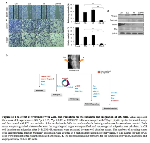 The effect of treatment with ZOL and radiation on the invasion and migration of OS cells