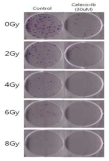 Colony forming assay for combination effect of radiotherapy and celecoxib on cell viability in A549 cells