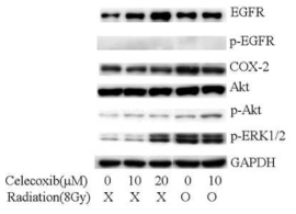 Western blot assay for combination effect of radiotherapy and celecoxib in A549 cells