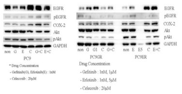 Western blot analysis for gefitinib, erlotinib and/or celecoxib treatment with in PC9, PC9GR and PC9ER cells