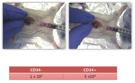 CD 34 양성 세포와 CD34 음성 세포를 이용한 orthotopic xenograft