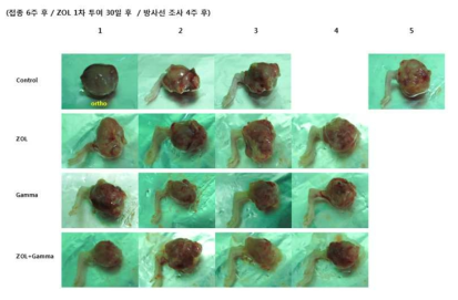 Gross tumor size