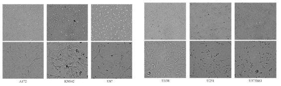 6개의 glioblastoma 세포주 배양조건 확립 및 배양