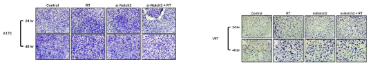 Migration assay results of A172, and U87 cells after knockdown of Notch 2 expression in each group (non treatment group: con, radiation alone:RT, siRNA for Notch2 treatment: si-Notch2, combination of radiation and siRNA treatment: RT+siNotch2)