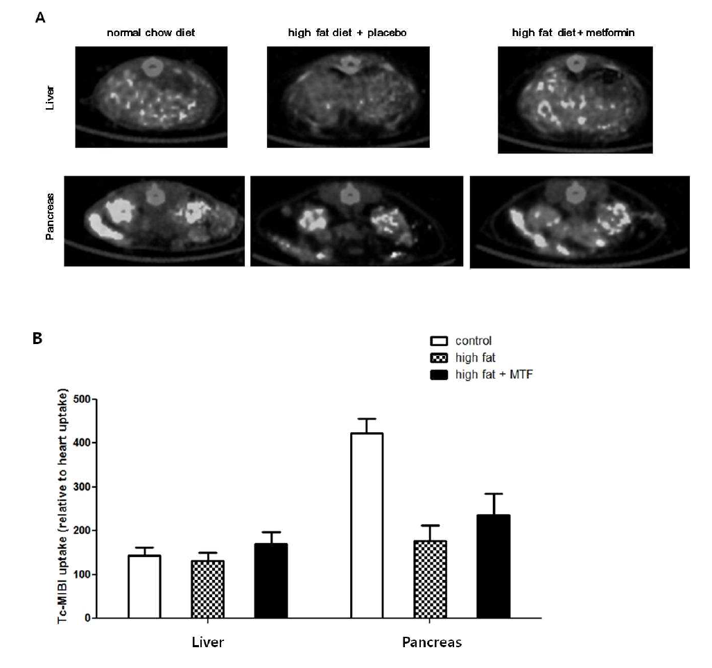 6주간 고지방식이와 2주간 metformin투여가 SPECT CT 영상의 간과 췌장 Tc-MIBI uptake pattern에 미치는 효과 (A) SPECT CT image of liver / pancreas (B) Tc-MIBI uptake (heart uptake를 100%로 하였을 때)