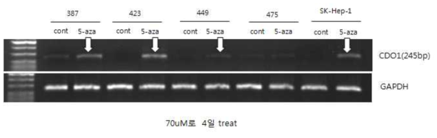 CDO1 gene expression. In HCC cell lines, CDO1 gene expression is enhanced (white arrows) after demethylation treatment (5-Aza-dC treatment) compared to control cell lines (RT-PCR). We selected the SNU-387 and SNU-423 cell lines for further experiment