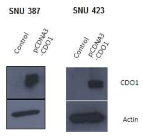 Western blot. CDO1 protein is hyperexpressed after si RNA treatment