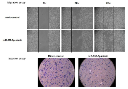 miR-338-5p에 의한 cell migration과 invasion의 변화