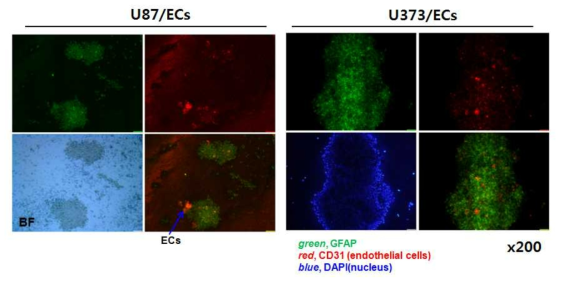공배양 spheroid에서 혈관세포와 암세포의 분포