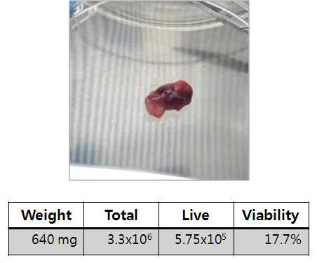 환자 유래 암조직과 cell viability