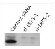 ERK5 siRNA에 의한 ERK5 단백질 발현량 감소 확인