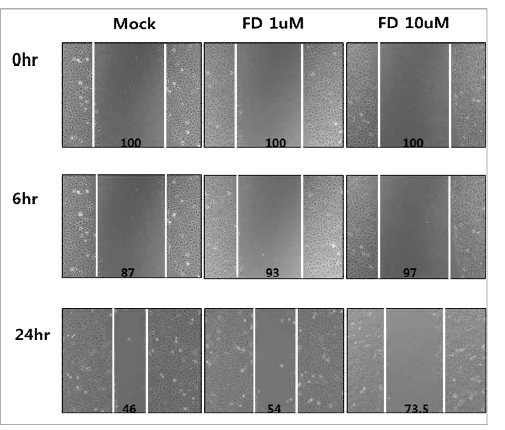 NCC-FD에 의한 SKOV-3 세포의 serum에 의한 wound healing 저해 효능