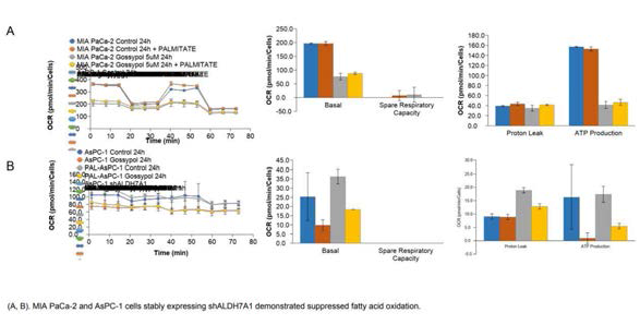 ALDH 7A1 silencing을 통한 지방산 산화 억제(fatty acid oxidation) 확인