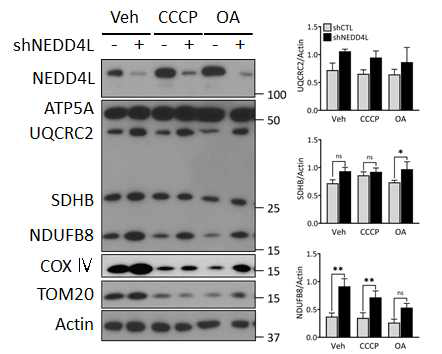 NEDD4L 결핍세포에서 안정화되는 미토콘드리아 전자전달계 단백질과 막단백질
