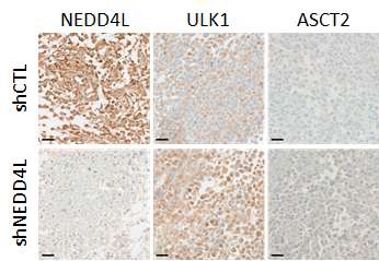 Xenograft마우스로부터 적출 암에서 histology 분석