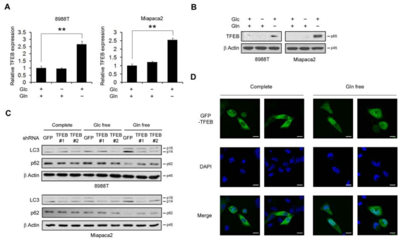 TFEB transcription factor regulates autophagy upon glutamine deprivation. (A and B) The expression of TFEB was determined by quantitative RT-PCR (A) or western blot (B) in PDAC cells 24 h after supplementing with glucose or glutamine-free medium. (C) PDAC cells expressing a control (shGFP) or TFEB shRNAs (shTFEBs) were plated in the complete medium, which was replaced with glucose or glutamine-free medium the following day and then incubated for another 24 h. Cell lysates were immunoblotted for LC3 and p62. (D) Subcellular localization of GFP-TFEB in MIAPaCa2 was monitored by fluorescent microscopy analysis after incubating for 24 hr under either glutamine-replete or glutamine-free conditions, 20 μm. Error bars represent the s.d. of triplicate wells from a representative experiment. **, p < 0.01