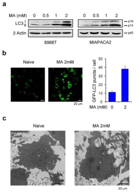 Effect of matrine on autophagy. (A) PDAC cells were treated with the indicated concentration of matrine for 24 h and immunoblotted with the indicated antibodies. (B) 8988T cells expressing GFP-LC3 were treated with 2-mM matrine for 24 h and analyzed for LC3 dots. (C) Autophagic vacuoles in 8988T cells treated with 2-mM matrine for 24 h were analyzed by transmission electron microscopy. Notes: N, nucleus; L, lipid; A, autophagic vacuoles