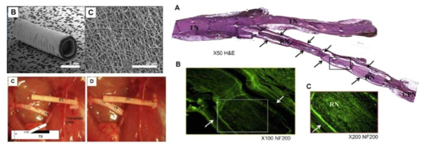 PCL과 collagen을 이용하여 제작된 신경도관과 in-vivo test및 결과