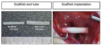선택적 투과성 외막(PCL tube, 18mm) 및 일정한 방향성을 지닌 내부 미세구조(Scaffold, 16mm)의 이중구조(왼쪽) 및 소동물 신경절단모델 내 이식 사진(오른쪽)