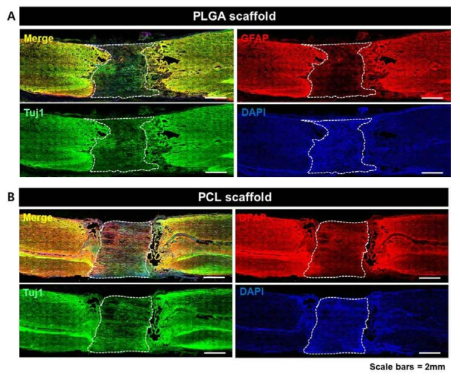 미니피그 척수완전절단모델 내 PLGA(A) 및 PCL(B)소재 미세구조 신경도관 이식 12주 후 면역형광 조직염색 결과 (점선 내부는 신경도관 내부, 축삭염색은 Tuj1, 초록색)