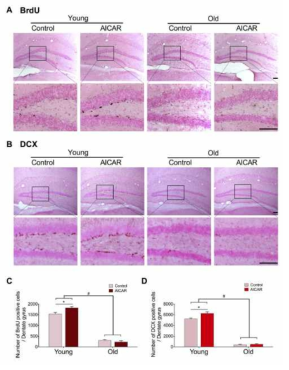 노화에 따른 neurogenesis감소. AMPK를 활성시켜주었을 때 젊은 쥐에서는 neurogenesis가 유의하게 증가하나, 노화된 쥐의 해마에서는 애초에 neurogenesis level이 낮을 뿐 아니라, AMPK활성시에도 반응이 없음을 알 수 있었음. 이는 PM과 같은 독성 물질의 노출시 에너지 스트레스에 대응하는 능력이 노화에 의해 감소될 수 있음을 보여주는 결과로, 노화에 의한 환경유해물질 감수성은 증가되는 것을 의미함