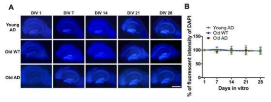 4주간의 절편 배양에서 젊은 치매 쥐 (4개월령), 고령 치매 쥐 (12-14개월), 고령 정상 쥐 (BL6, 12-14개월령)의 세포 구조변화를 관찰. 본 연구진이 개발한 장기배양법으로 고령의 치매 쥐 해마조직도 성공적으로 구조가 유지됨을 확인함