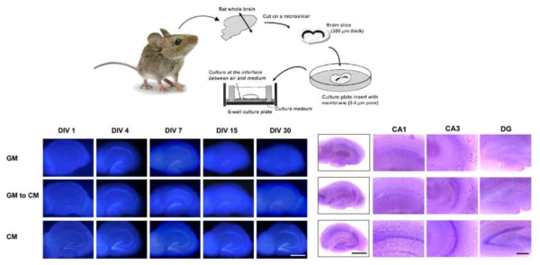 기관특징적 뇌절편 배양 시스템 (Kim et al. Organotypic hippocampal slice culture from the adult mouse brain: a versatile tool for translational neuropsychopharmacology. Prog Neuropsychopharmacol Biol Psychiatry. 2013;41:36-43)