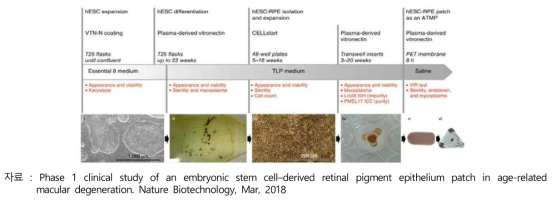 배아줄기세포 생성부터 황반변성 첨단재생의료 치료제 개발 과정