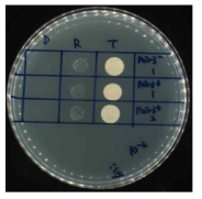 Donor, recipient 및 transconjugant 확인시험