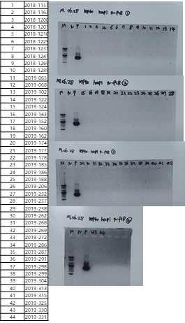다기관 코호트로부터 확보한 렙토스피라증 의심 임상 검체를 대상으로 렙토스피라증 진단을 위해 수행한 L. interrogans-specific hapI nested PCR 후 전기영동 사진