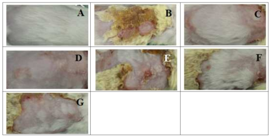 Clinical skin features and severity of DNCB-induced dermatitis in BALB/c mice. Normal group (A), DNCB group (B), A 1× goup (C), A 0.1× group (D), B 1× group (E), and B 0.1× group (F), B 0.01 × group (G) mice skin features are shown