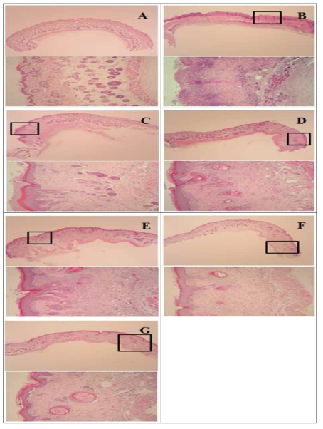 Pathological leisons of skin features. Normal group (A), DNCB group (B), A 1× goup (C), A 0.1× group (D), B 1× group (E), and B 0.1× group (F), B 0.01× group(G) mice of pathological lesions on skin are shown