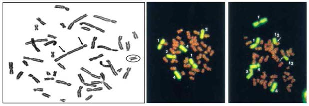 세포유전학적 선량평가(왼쪽: 림프구 조사 후 검출된 불안정형 염색체 변형, 오른쪽: 형광 소식자로 보합된 세포분열 중기 염색체)