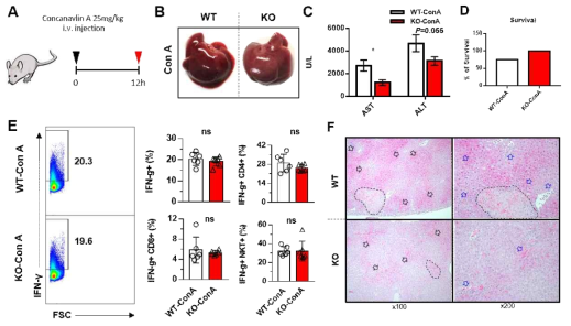 IPMK KO에 고농도(25mg/kg)의 Concancavalin A 주입 후 마우스 표현형 확인. A WT과 IPMK KO에 Concancavalin A (25mg/kg, 12시간) 주입 후, B 간 표면 상 손상 정도 확인. C 혈청 ALT, AST 레벨 확인. D 간 내 염증 사이토카인 IFN-γ발현과 림프구 내 발현 분석. F 간의 조직학적 분석 (화살표: 용혈, 점선: necrotic area)