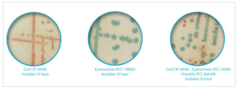 ChromID ESBL 배지에 증식한 ESBL 생성 장세균의 집락 모습. 왼쪽, ESBL 생성 E. coli (Burgundy color); 가운데, ESBL 생성 K. pneumoniae (Green); 오른쪽, ESBL 생성 E. coli, ESBL 생성 K. pneumoniae, ESBL 생성 P. mirabilis (Brwon)