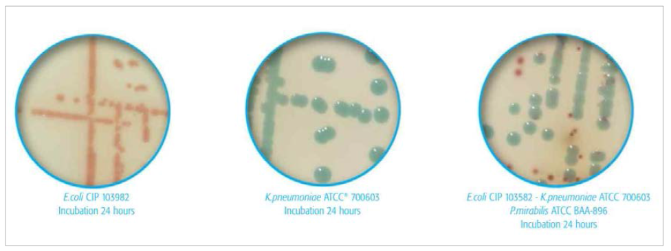 ChromID ESBL 배지에 증식한 ESBL 생성 장세균의 집락 모습. 왼쪽, ESBL 생성 E. coli (Burgundy color); 가운데, ESBL 생성 K. pneumoniae (Green); 오른쪽, ESBL 생성 E. coli, ESBL 생성 K. pneumoniae, ESBL 생성 P. mirabilis (Brwon)