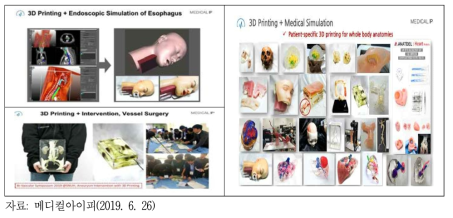 Medical IP의 3D프린팅 기술 활용 사례
