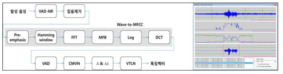 잡음제거 알고리즘/기술 및 특징정보추출 기술개발/모듈화