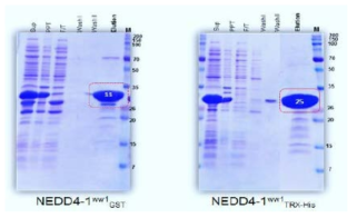 NEDD4-1WW1 단백질의 분리 정제 조건 최적화