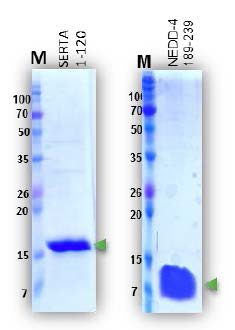 NMR 실험을 위한 isotope labelled p341-120 단백질과 NEDD4-1WW1 단백질의 정제 결과