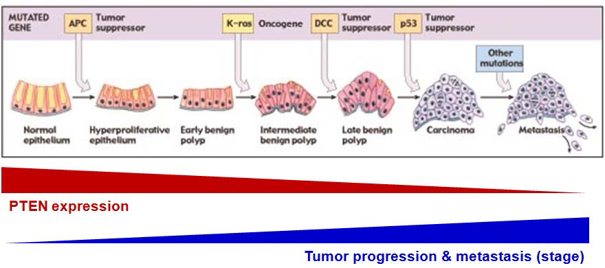 대장암발생 및 전이과정과 PTEN 발현의 연관성