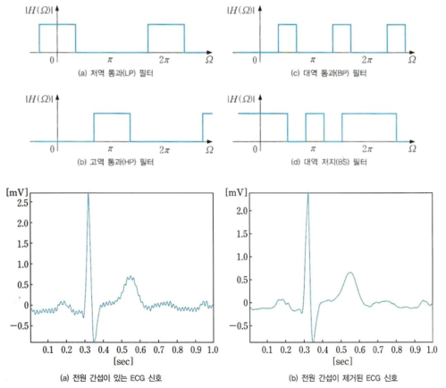 디지털 신호 처리 - 필터링 (상: 주파수 선택 필터 유형, 하: 노치 필터에 의한 전원 간섭 제거 효과)