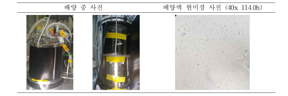 PB75 5L 8차 배양 결과 (현미경 사진)