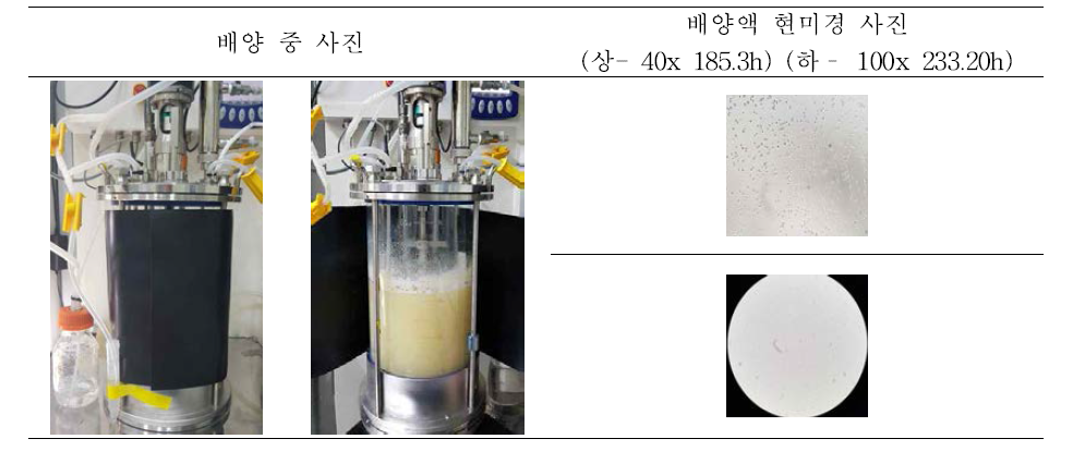 PB75 5L 10차 배양 결과 (현미경 사진)